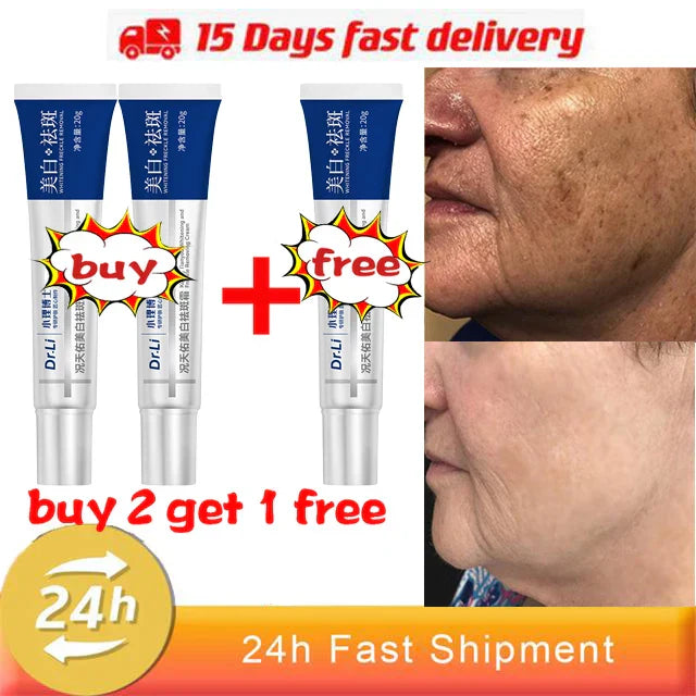 Whitening Freckles Cream - Korean Skincare