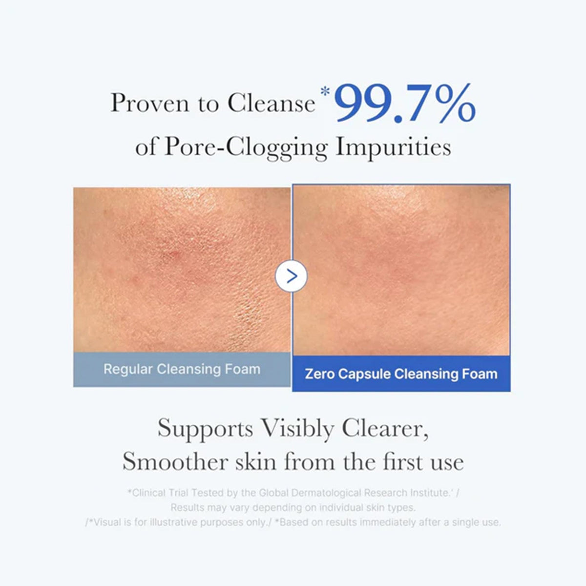 Medicube Zero Pore SA Clear Capsule Cleansing Foam 120ml Tube