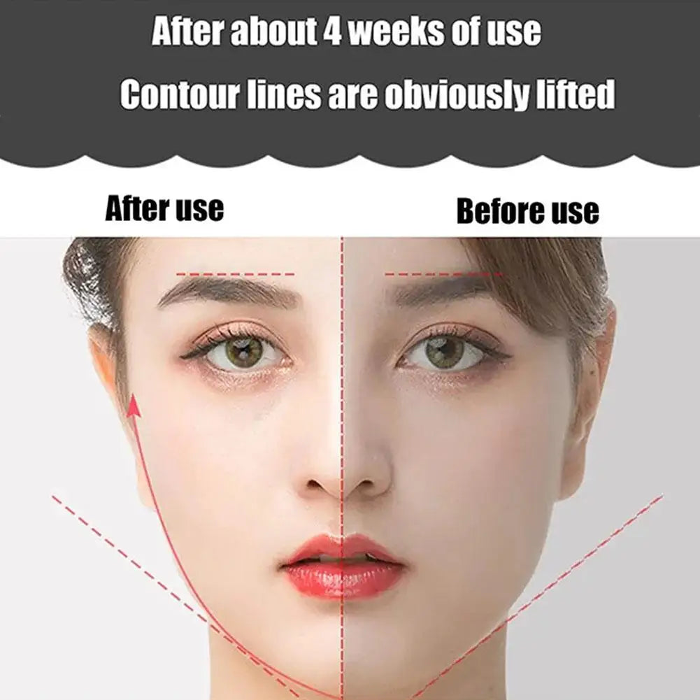 Face Lifting Roller – 3D Y-Shape EMS Microcurrent Facial Massager