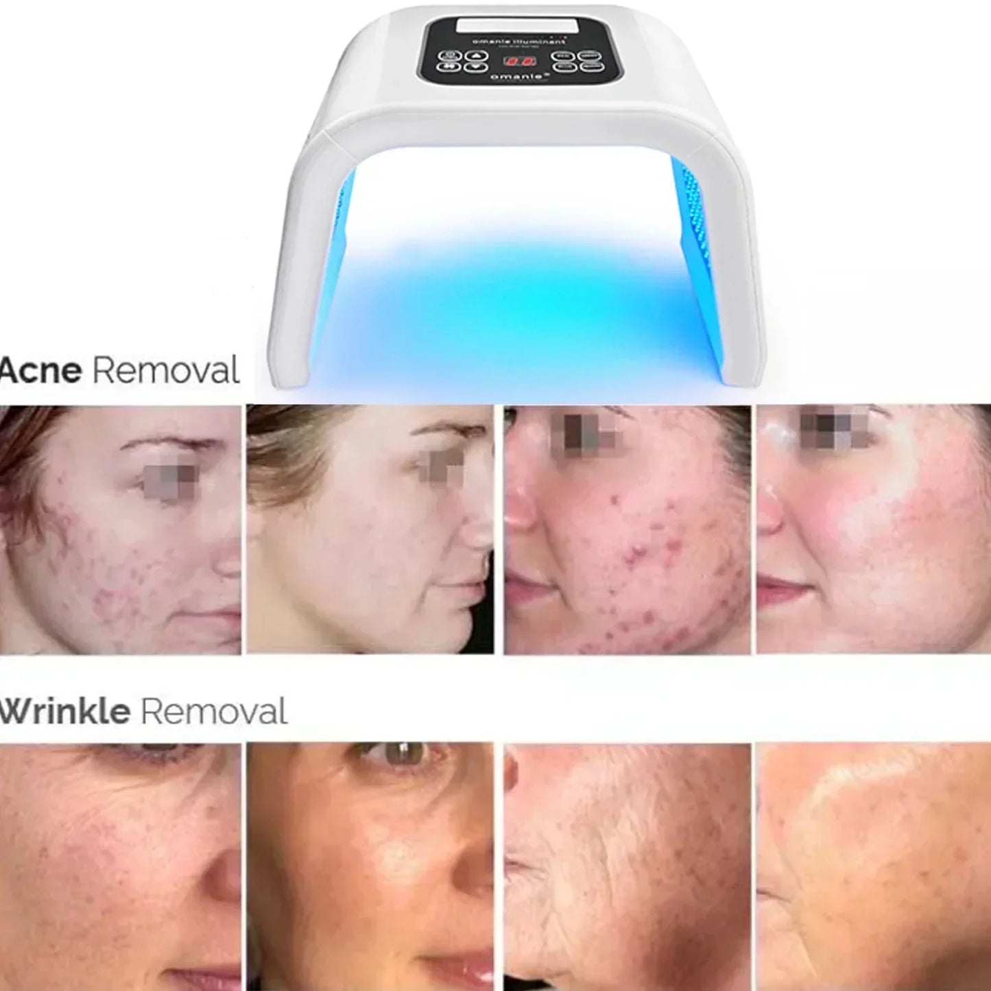 7-Color LED Photon Heating Facial Mask for Home Skin Care