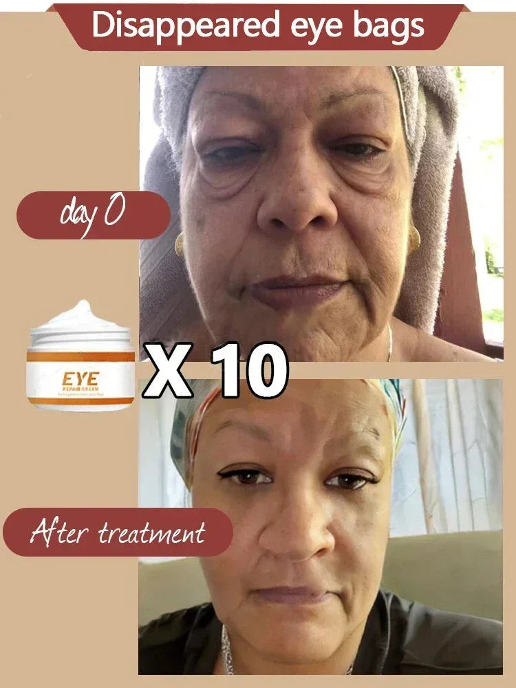 Anti-Wrinkle Eye Cream - Bags, Puffiness, Dark Circles, Fine Lines, Moisturizing, Whitening