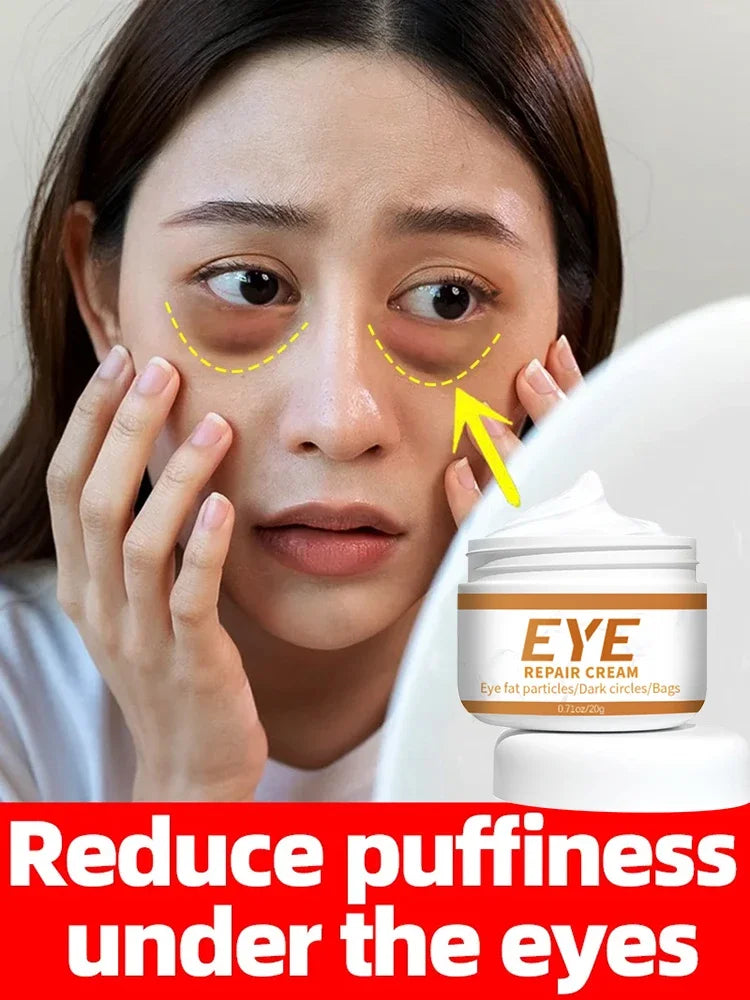 Anti-Wrinkle Eye Cream - Bags, Puffiness, Dark Circles, Fine Lines, Moisturizing, Whitening