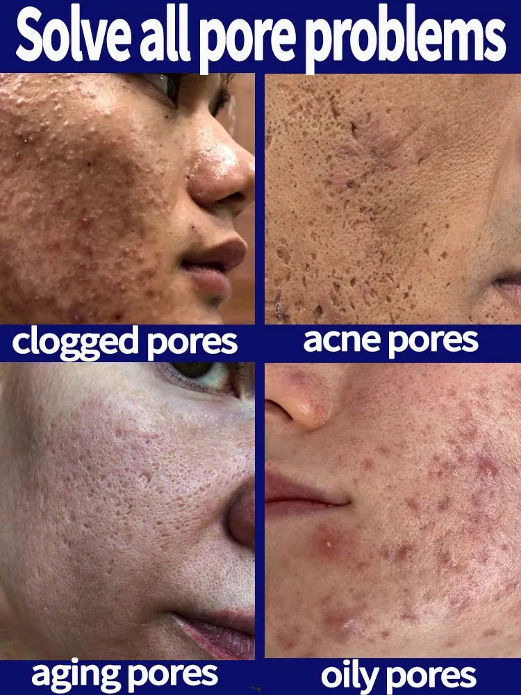 Radiant Glow Pore Minimizing Serum