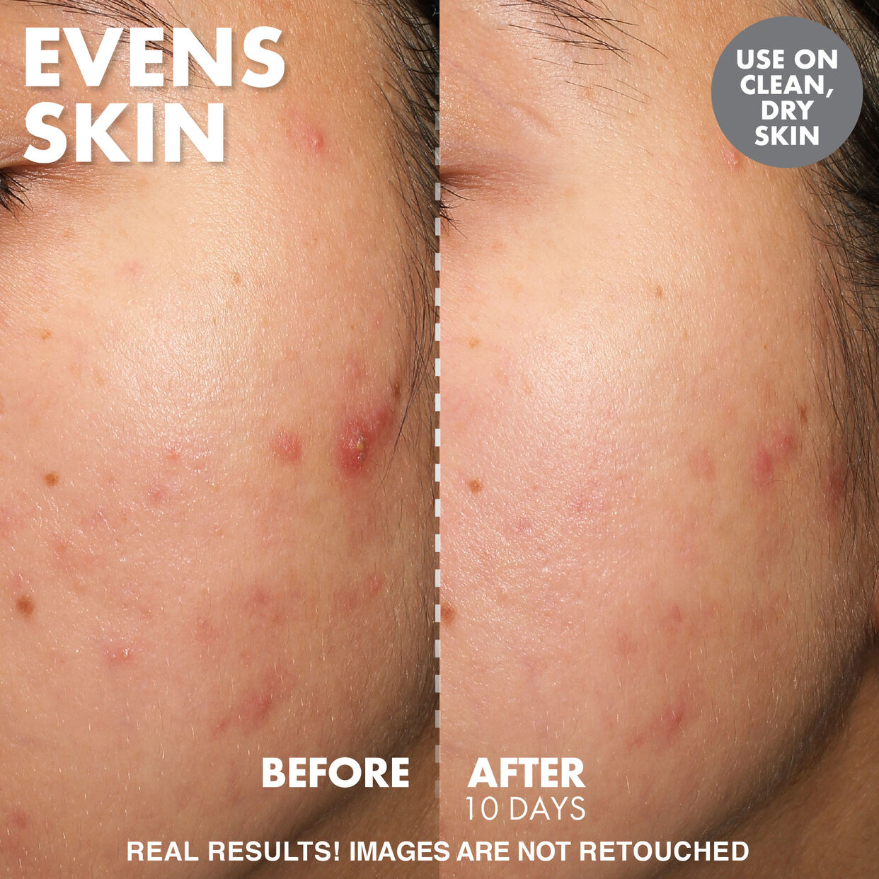 Yo Glow AHA & BHA Facial Enzyme Scrub